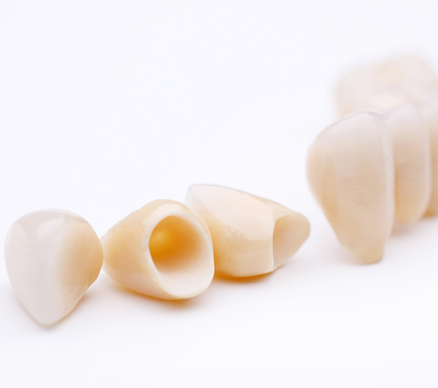 Roswell Dental Crowns and Dental Bridges