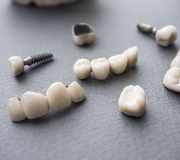 Roswell The Difference Between Dental Implants and Mini Dental Implants