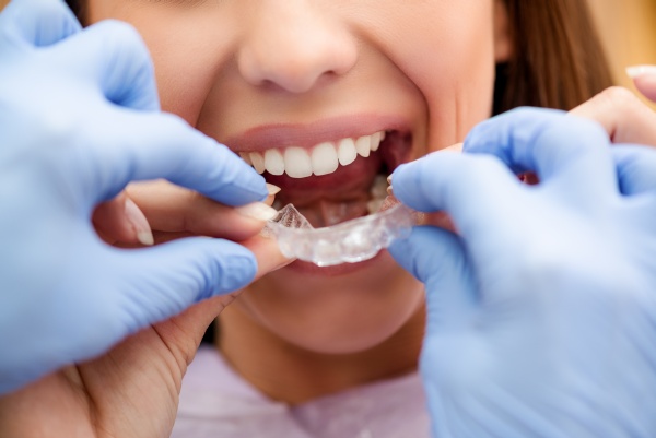 Important Information About  Adult Orthodontics