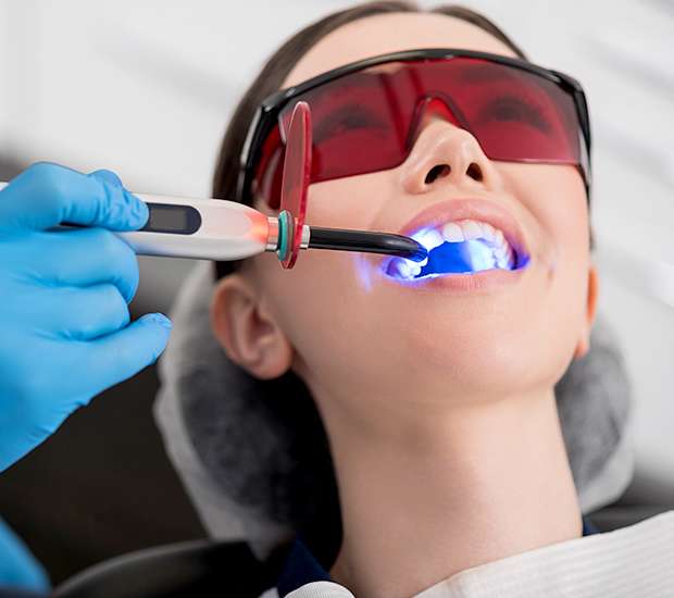 Roswell Professional Teeth Whitening