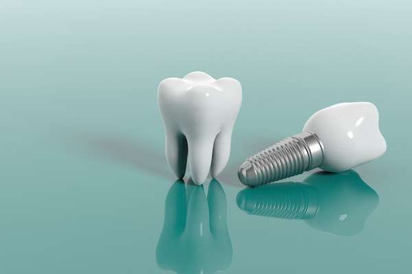 Multiple Teeth Replacement Options: One Implant for Two Teeth from Roswell Dental Smiles in Roswell, GA